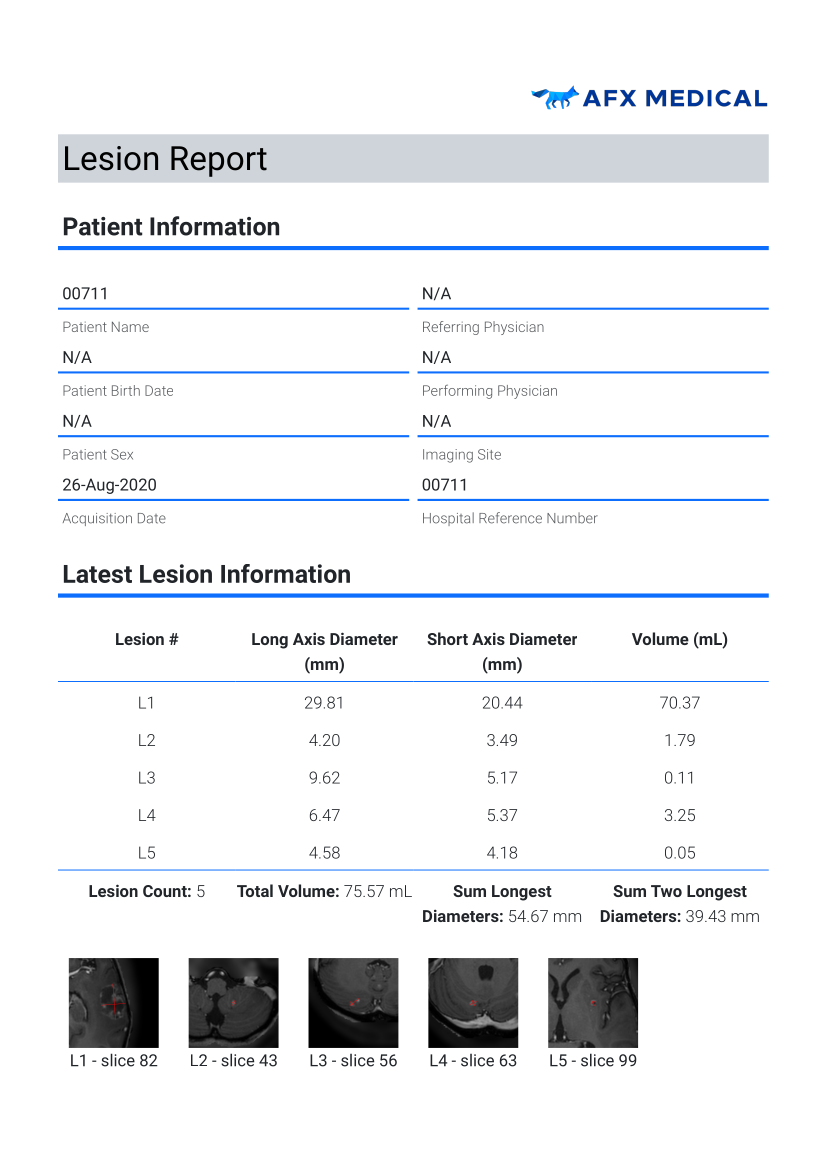 first page of brain metastasis report
